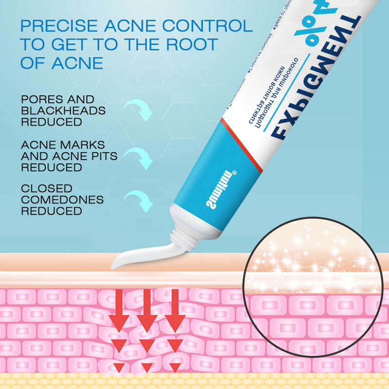 Expigment Cream (4% hydroquinone) | Topical Cream for Dark Spots, Acne Spots, Sun Spots, Age Spots, and Melasma