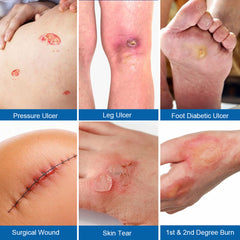 Silicone Gel Dressing (2 pieces/pack) | Waterproof and Breathable Band Aid for Wound Dressing