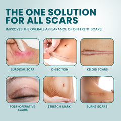 Silicone Scar Tape (Extra long, 4×300cm, White color) | Scar Repair Sheet for New & Old Scars and Stretch Marks