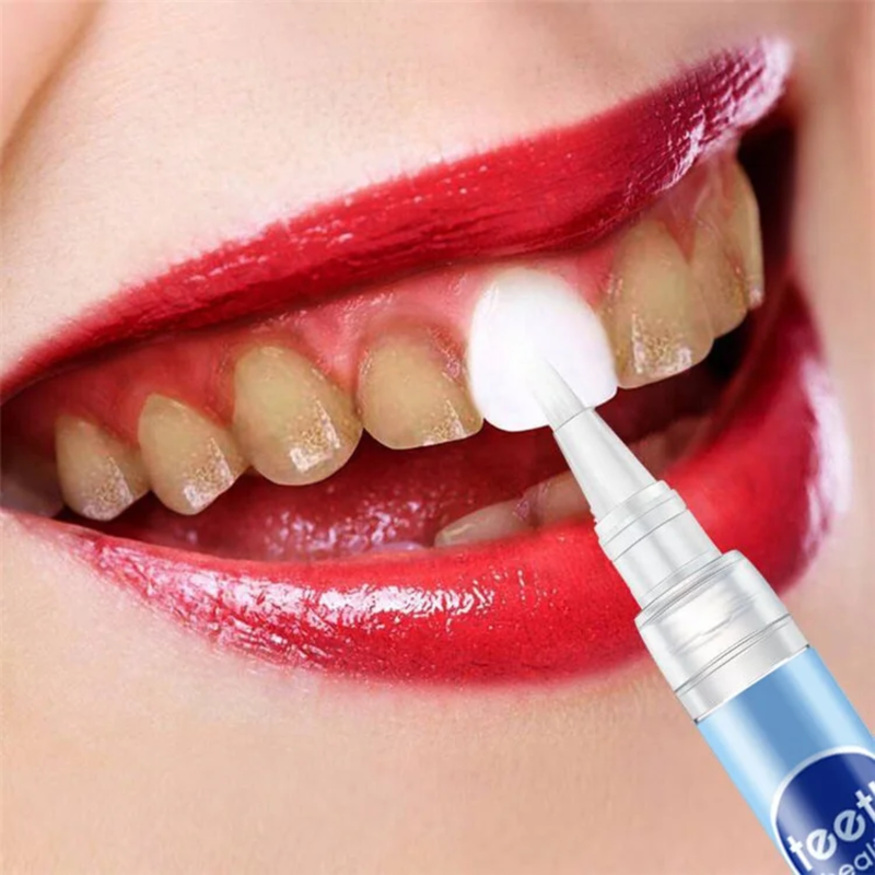 LANSIYI Toothpaste Pen | Teeth Whitening and Stain Removal Pen