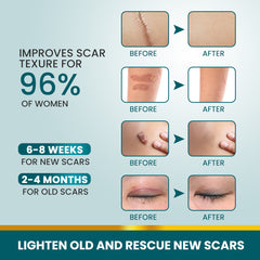 Silicone Scar Tape (Extra long, 4×300cm, White color) | Scar Repair Sheet for New & Old Scars and Stretch Marks