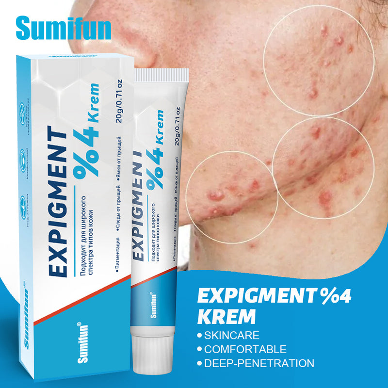 Expigment Cream (4% hydroquinone) | Topical Cream for Dark Spots, Acne Spots, Sun Spots, Age Spots, and Melasma