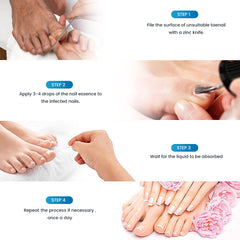 Nail Fungus Liquid (15ml) | Topical Ointment for Ingrown Nails, Brittle Nails, Thick Nails, Sinking Nails, and Discolored Nails