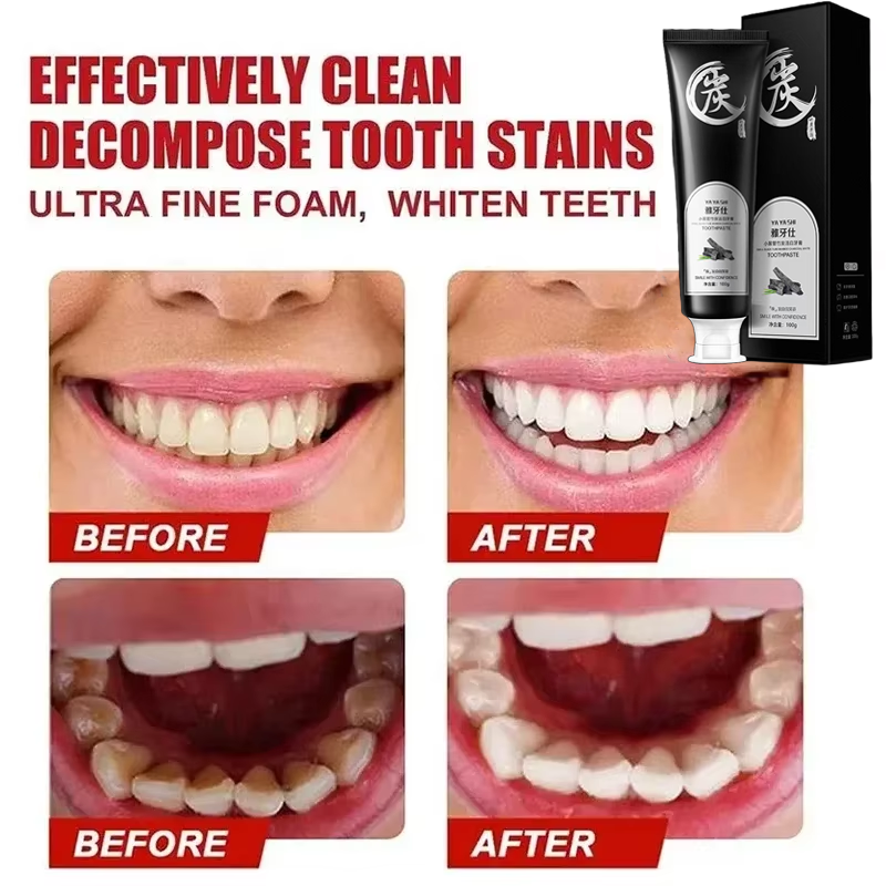 YAYASHI Bamboo Charcoal Whitening Toothpaste (100grams) | Herbal Toothpaste for Stubborn Stains, Fresh Breath, Plaque, Healthy Gums, and Teeth Whitening