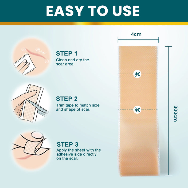 Silicone Scar Tape (Extra long, 4×300cm, White color) | Scar Repair Sheet for New & Old Scars and Stretch Marks