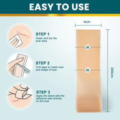 Silicone Scar Tape (Extra long, 4×300cm, White color) | Scar Repair Sheet for New & Old Scars and Stretch Marks