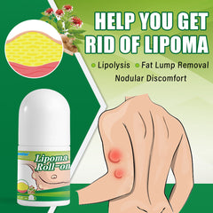 Lipoma Roll-On | Topical Ointment for Lipolysis, Fat Lump, and Nodular Discomfort