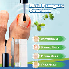 Nail Fungus Liquid (15ml) | Topical Ointment for Ingrown Nails, Brittle Nails, Thick Nails, Sinking Nails, and Discolored Nails