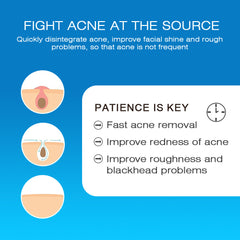 Expigment Cream (4% hydroquinone) | Topical Cream for Dark Spots, Acne Spots, Sun Spots, Age Spots, and Melasma