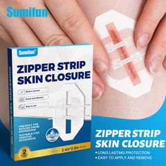 Zipper Strip Skin Closure for Wound Dressing (2 pieces)