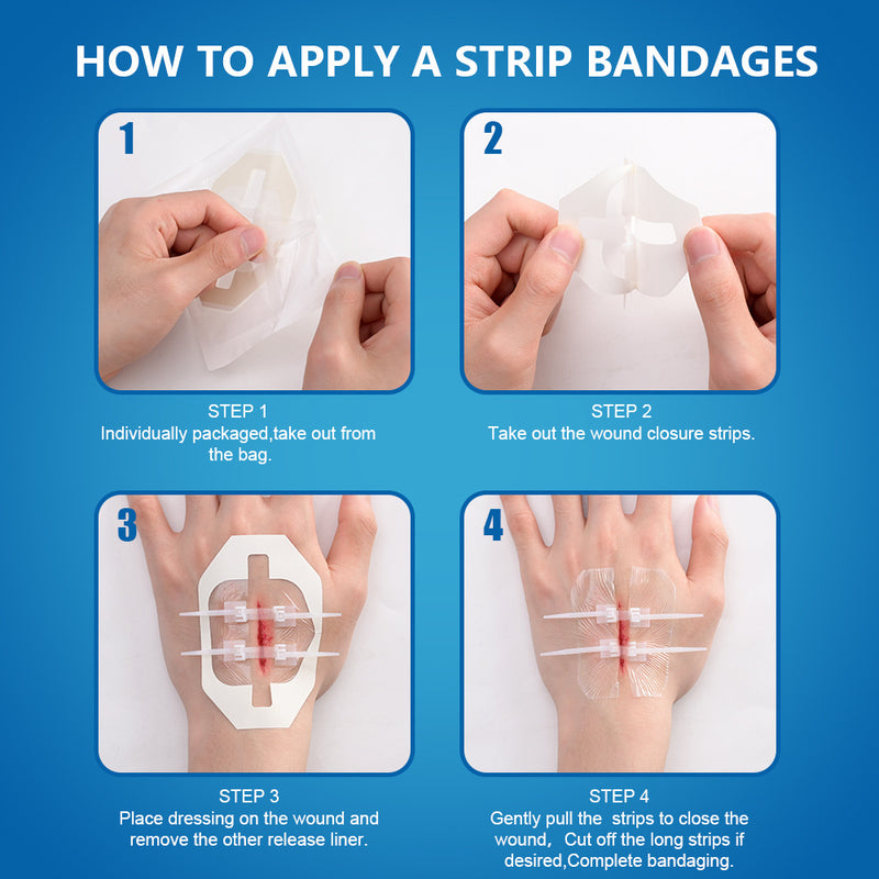 Zipper Strip Skin Closure for Wound Dressing (2 pieces)