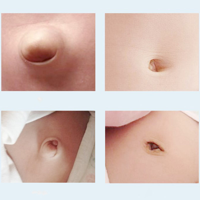 Infantile Umbilical Hernia Belt (0-1 year, 2 pieces, 6cm×45cm)