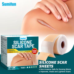 Silicone Scar Tape (Extra long, 4×300cm, White color) | Scar Repair Sheet for New & Old Scars and Stretch Marks