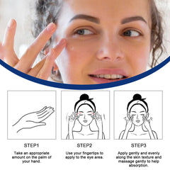 Under Eye Cream for Dark Circles | Topical Cream for Wrinkles, Eye Bags, and Dry Skin Around the Eyes