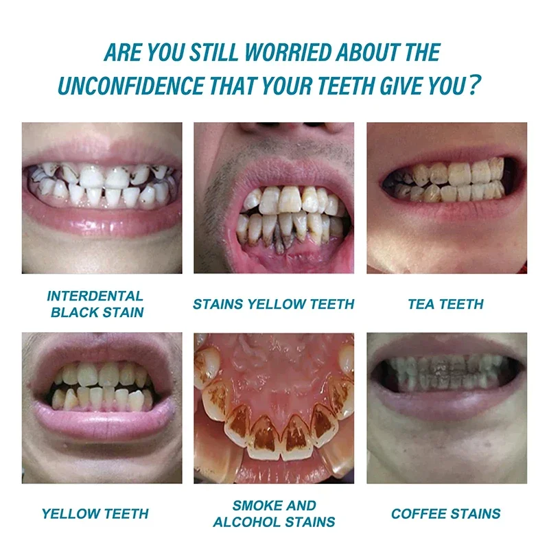 YAYASHI Bamboo Charcoal Whitening Toothpaste (100grams) | Herbal Toothpaste for Stubborn Stains, Fresh Breath, Plaque, Healthy Gums, and Teeth Whitening