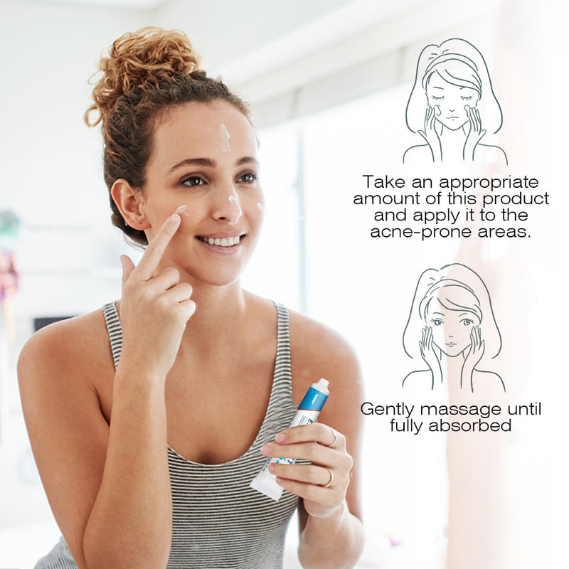 Expigment Cream (4% hydroquinone) | Topical Cream for Dark Spots, Acne Spots, Sun Spots, Age Spots, and Melasma