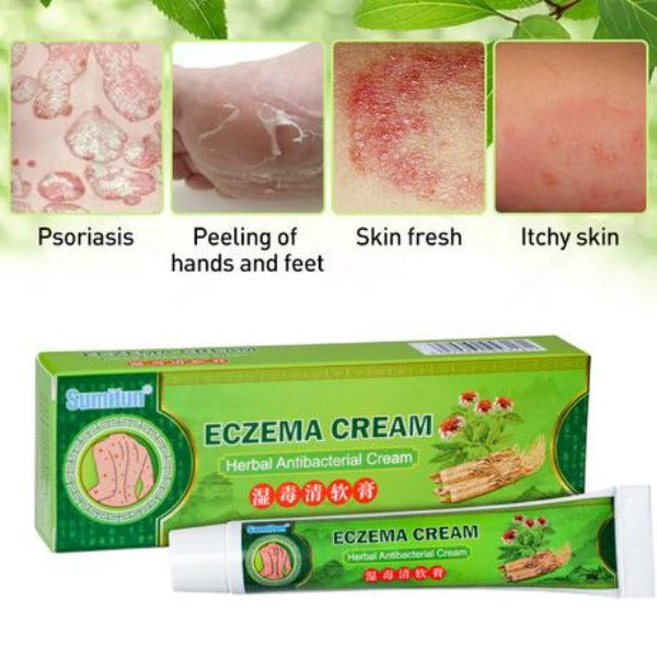 Eczema Cream | Herbal Cream for Treating Eczema, Psoriasis, and Skin Itching