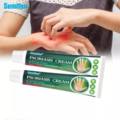 Psoriasis Cream | Herbal Cream for Psoriasis, Dermatitis, Eczema, and Itching
