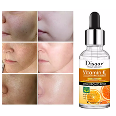 Vitamin C Face Serum with Hyaluronic Acid | Anti-Aging, Anti-Sunburn and Dark Spots Removal Face Serum