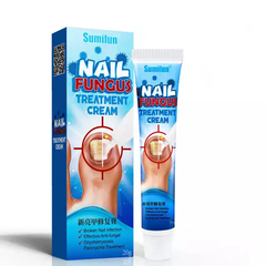 Nail Fungus Treatment Cream | Herbal Ointment for Fungal and Discolorated Nails