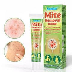 Mite Removal Ointment | Topical Cream for Eliminating Scabies Rash, Pubic Lice, and Mites