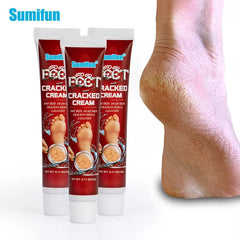 Cracked Hands and Feet Cream | Skin Ointment for Cracked Heels, Dry Skin and Dead Skin