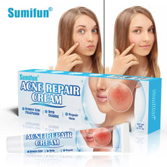 Acne Repair Cream | Herbal Ointment for Pimples, Acne Marks, Postules, and Blackheads