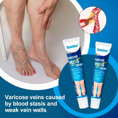Varicose Veins Cream | Herbal Cream for Spider Veins and Varicose Veins