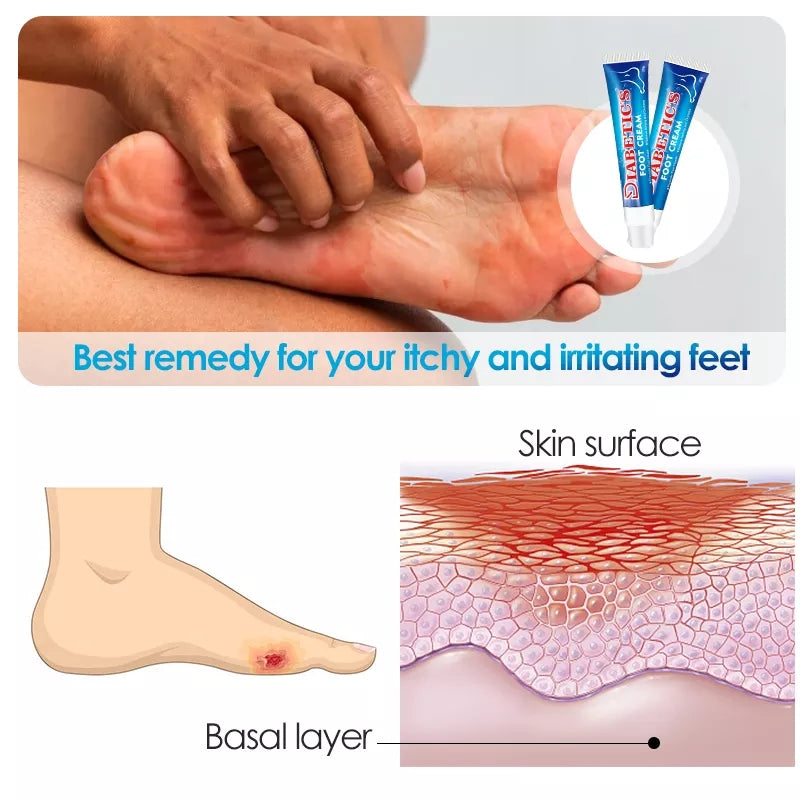 Home Remedy to Get Beautiful Feet: How soaking your feet in vinegar water  can help you heal