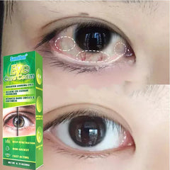 Eye Care Cream | Herbal Cream for Bright Eyes, Eye Fatigue, Dark Circles, and Puffiness