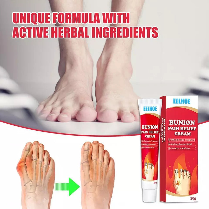 Bunion Pain Relief Cream | Herbal Cream for Bunions and Stiff Toes