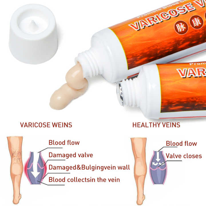 Varicose Veins Cream | Spider Veins Treatment Cream