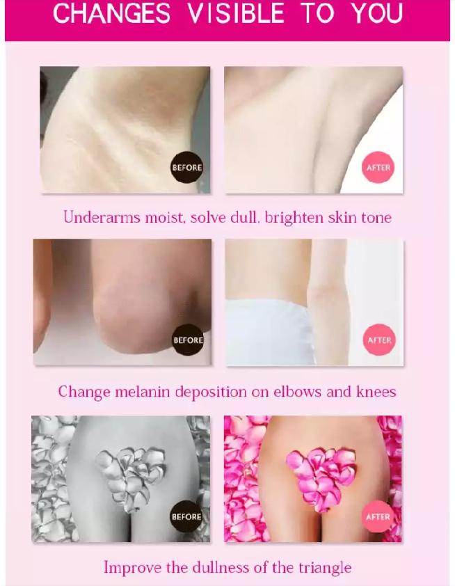 Underarm and Private Part Whitening Cream | For Sensitive Areas, Armpit, Knee, and Elbow
