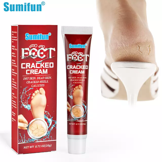 Foot cream for cracked feet discount